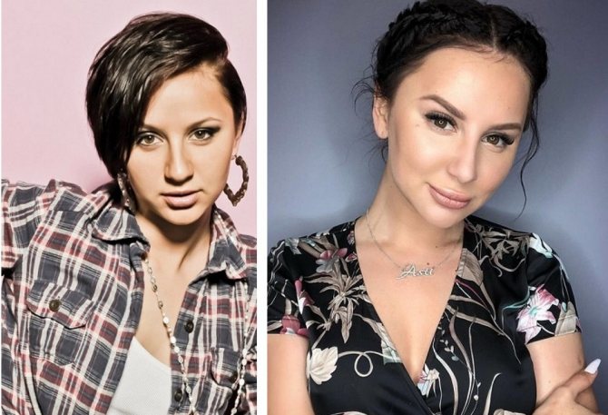 Асти до пластики