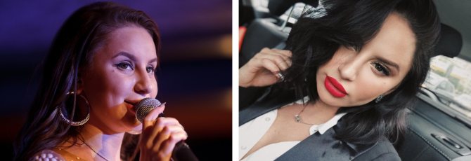 На фото: Анна Дзюба до после пластики