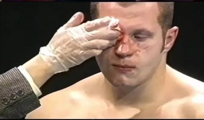 В 2000 Косаки рассёк Емельяненко лицо и был признан победителем